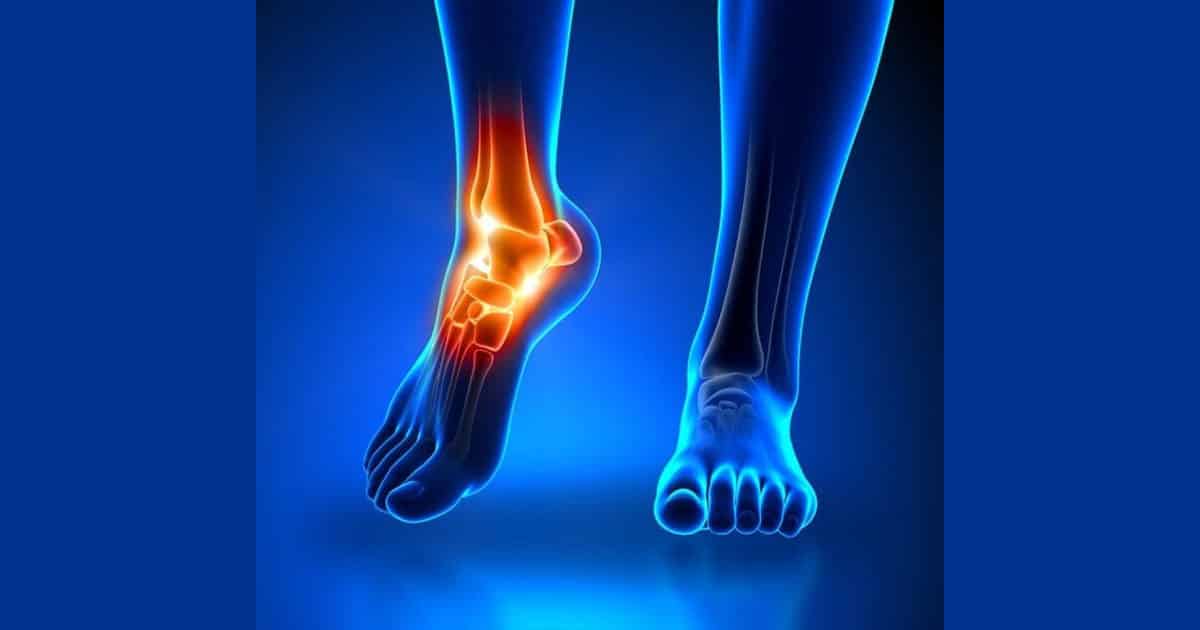 Ketamine IV Infusion Therapy Can Help With Complex Regional Pain Syndrome (CRPS)