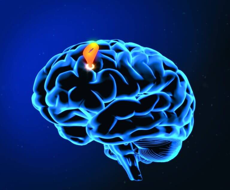 How Transcranial Magnetic Stimulation (TMS) Therapy Works