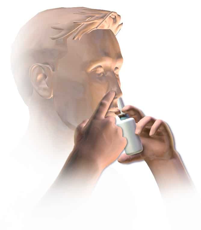 INTRAVENOUS KETAMINE VS ESKETAMINE NASAL SPRAY: WHICH IS BETTER FOR DEPRESSION TREATMENT?